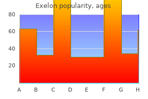 buy exelon toronto