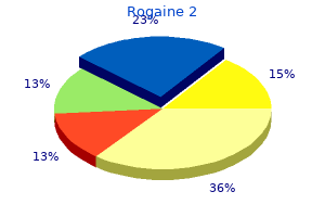 discount rogaine 2 express