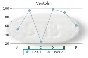 generic ventolin 100mcg