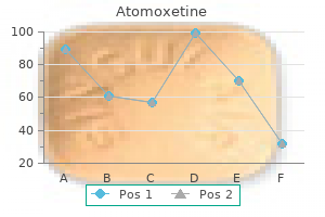 buy atomoxetine american express