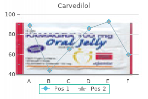 cheap carvedilol 12.5mg otc