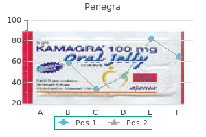 50mg penegra free shipping