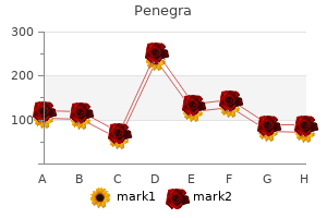 order 50mg penegra overnight delivery