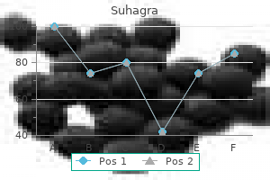 buy suhagra 50 mg otc