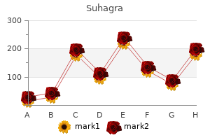 order 100 mg suhagra visa